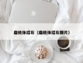 扁桃体结石（扁桃体结石图片）